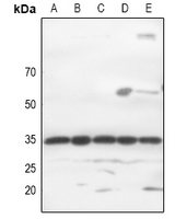 1 - Anti-GTF2E2 Antibody AP59574