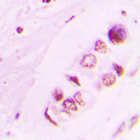 2 - Anti-Histone H3 (Acetyl-K9) Antibody AP59739