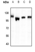 1 - Anti-PPFIBP1 Antibody AP59743