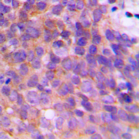 2 - Anti-KCNAB3 Antibody AP59772