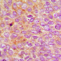 2 - Anti-Nephrocystin 5 Antibody AP59782