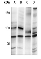 1 - Anti-SENP7 Antibody AP59859