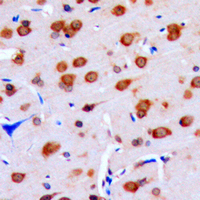 2 - Anti-DUSP16 Antibody AP59878