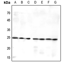 1 - Anti-MED9 Antibody AP59952