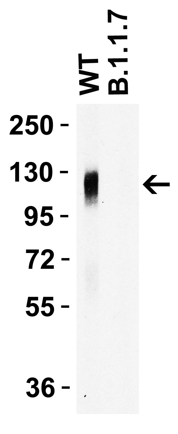 1 - SARS-CoV-2 (COVID-19) Spike 681P Antibody [8G10C8] ASC12193