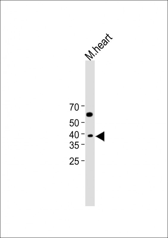 1 - CH25H Antibody (N-Term) AP22272a