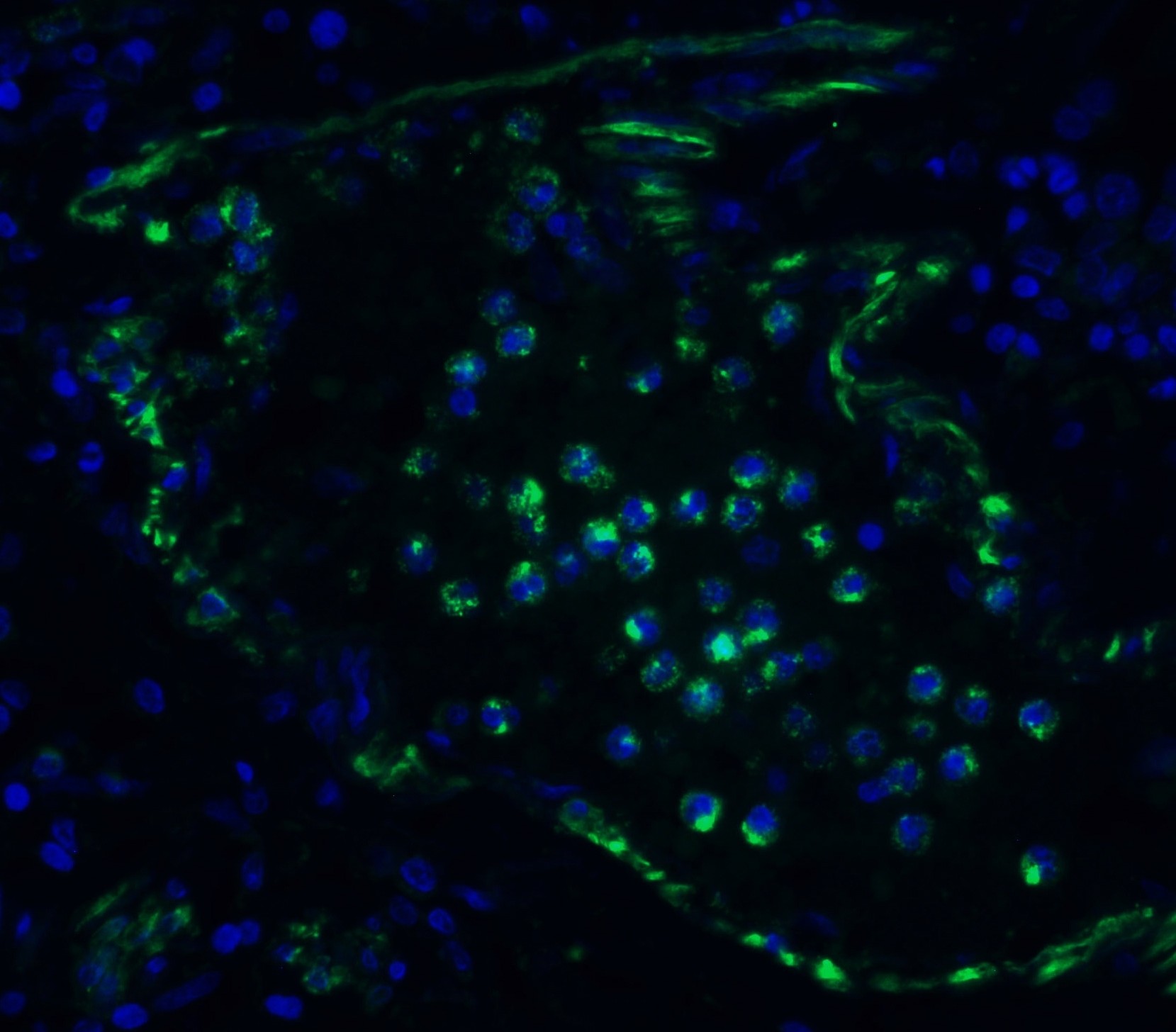 3 - TMEM41B (CT) Antibody ASC12204