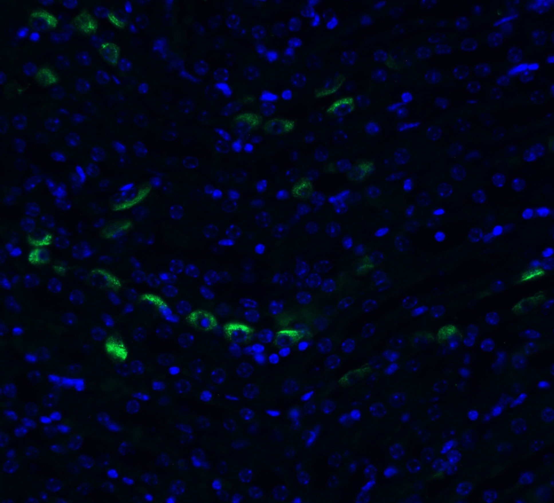3 - TMEM41B (CT) Antibody ASC12204
