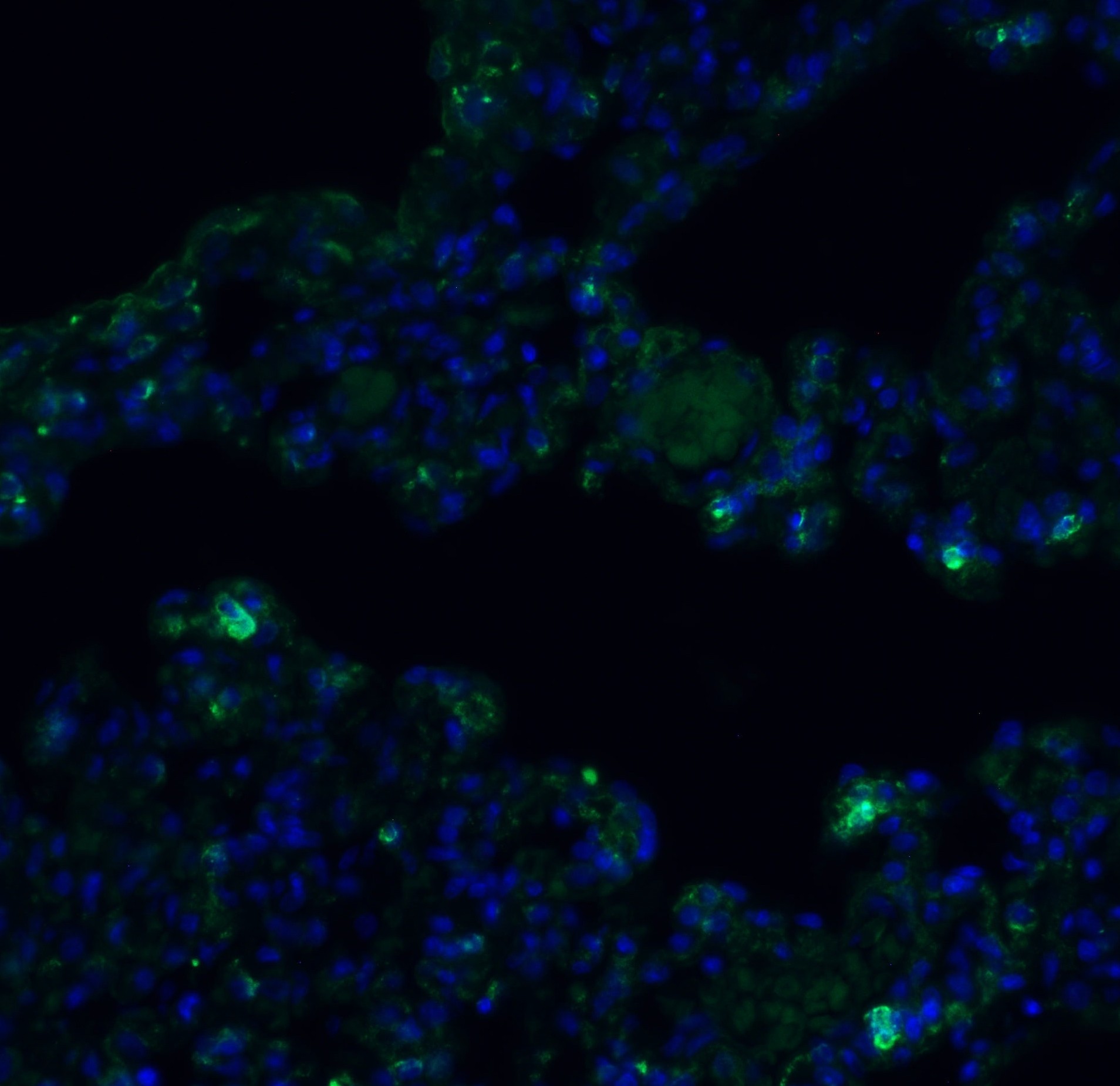 3 - TMEM41B (CT) Antibody ASC12204