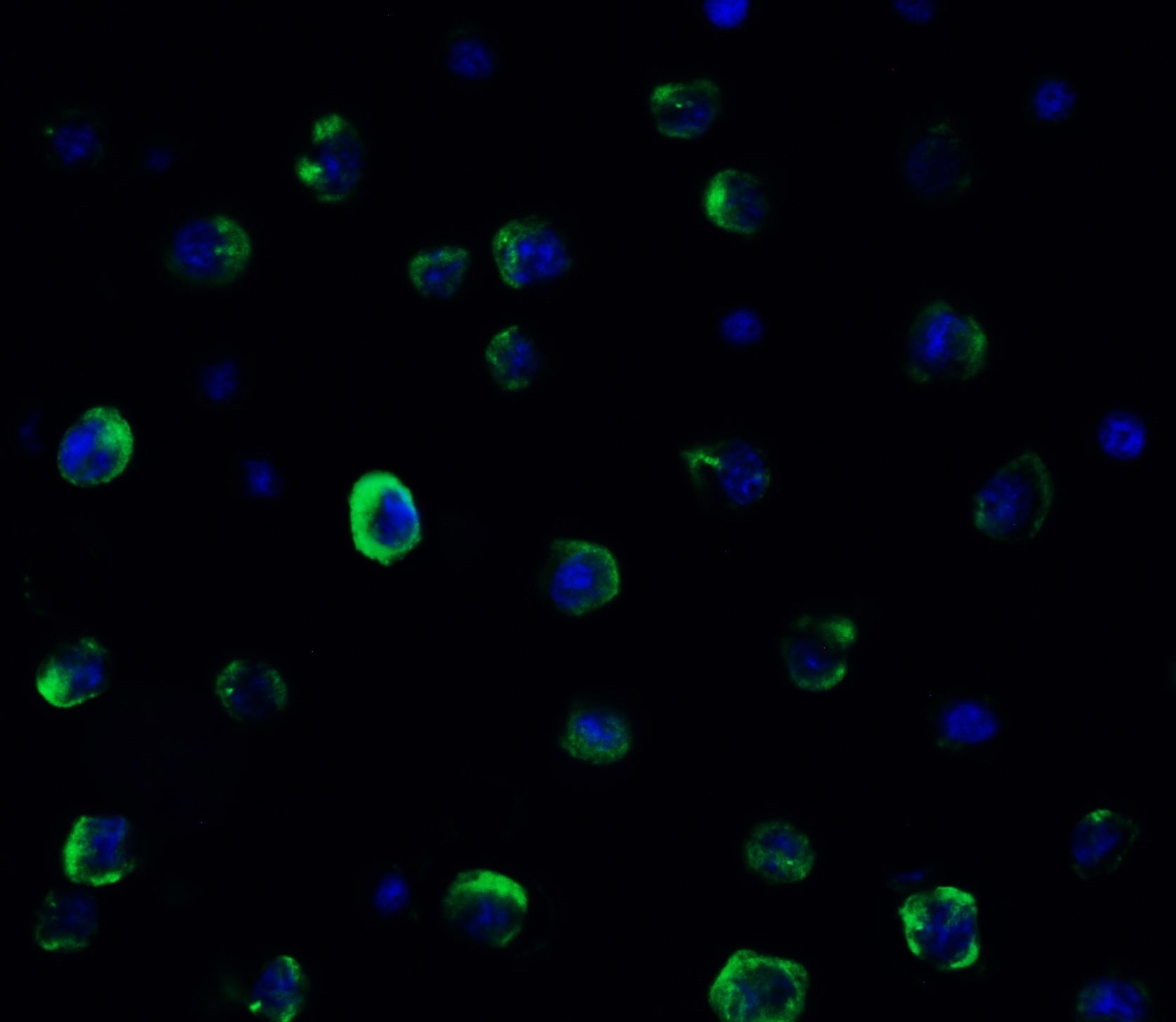 3 - TMEM41B (CT) Antibody ASC12204
