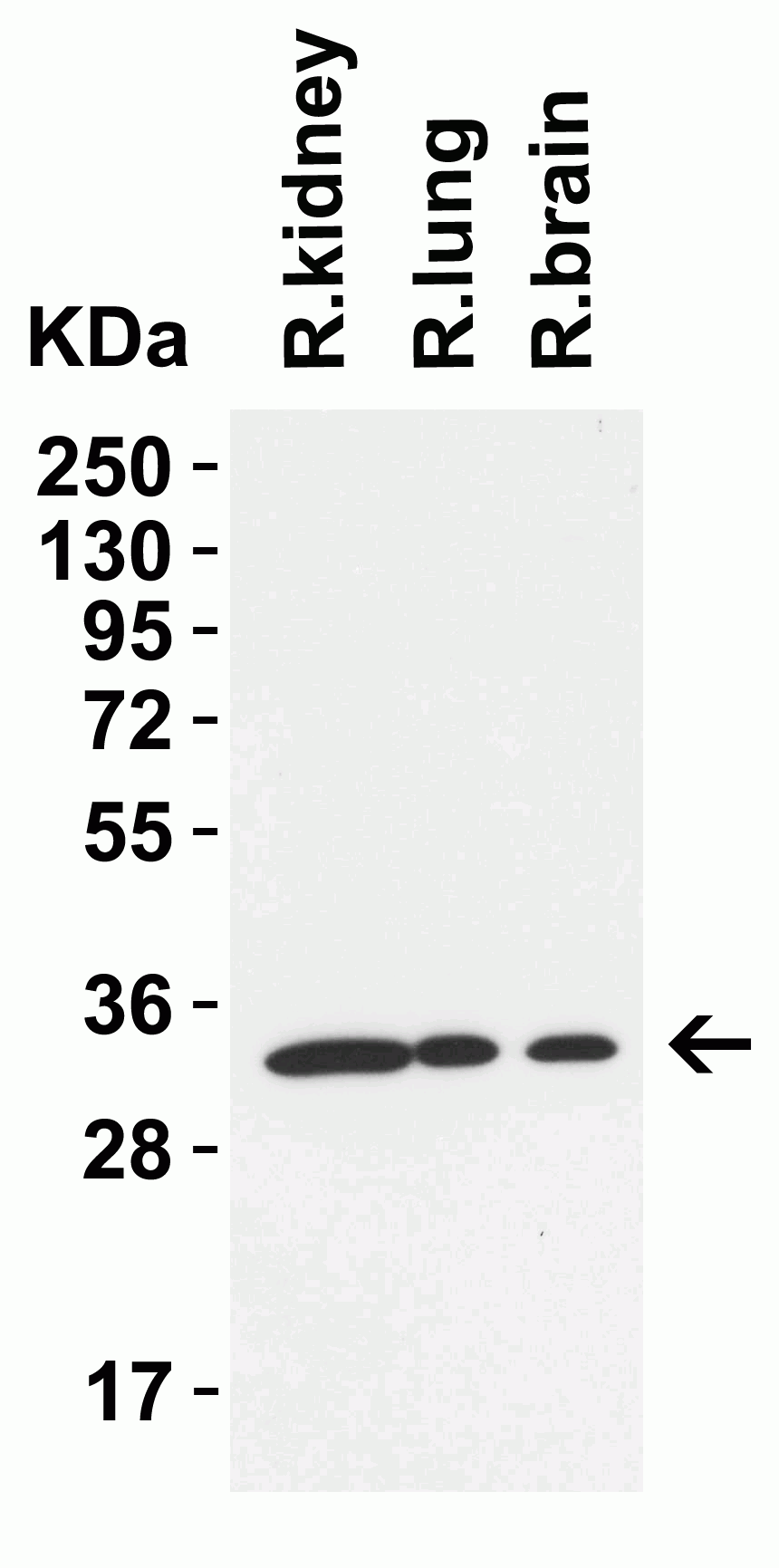 1 - TMEM41B (CT) Antibody ASC12204