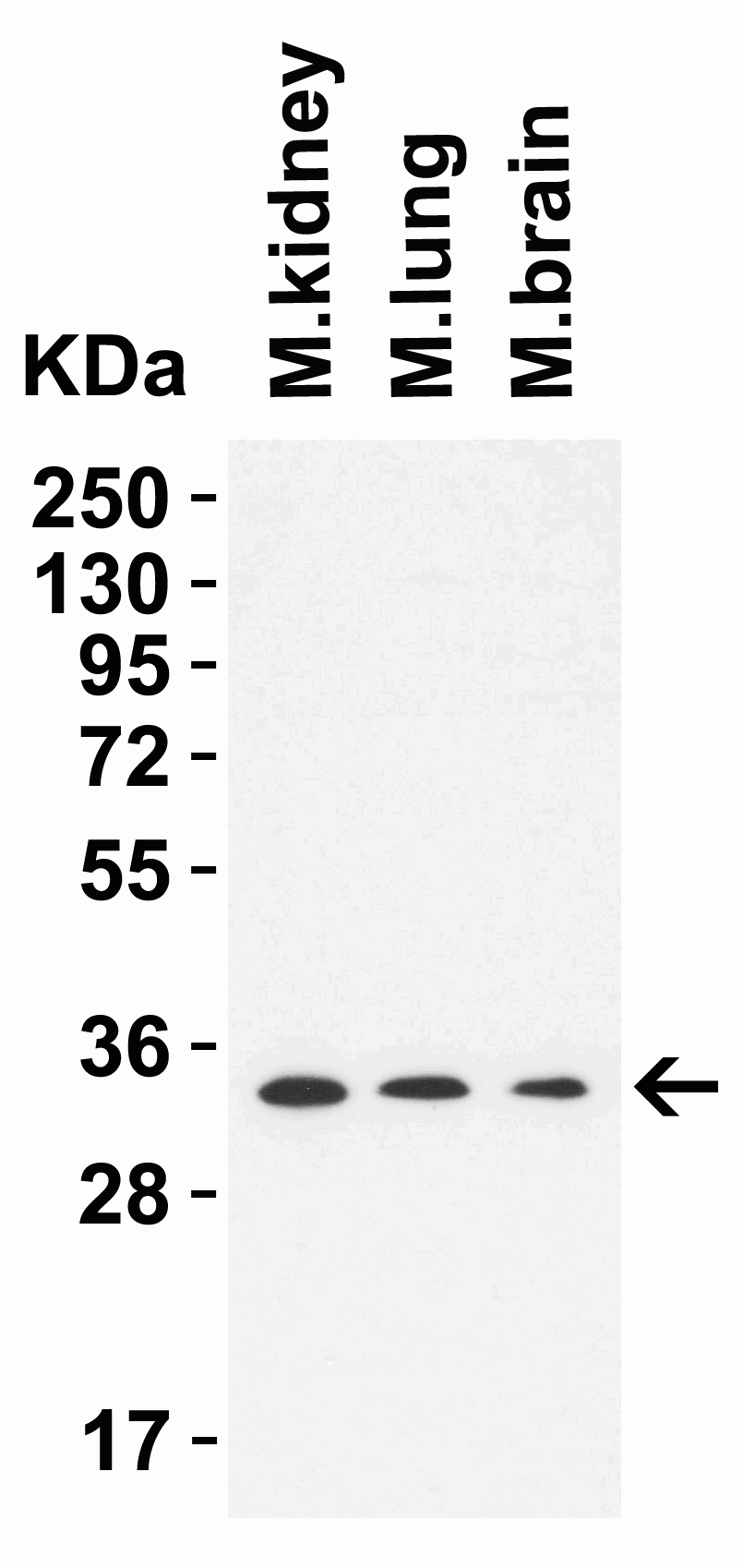 1 - TMEM41B (CT) Antibody ASC12204