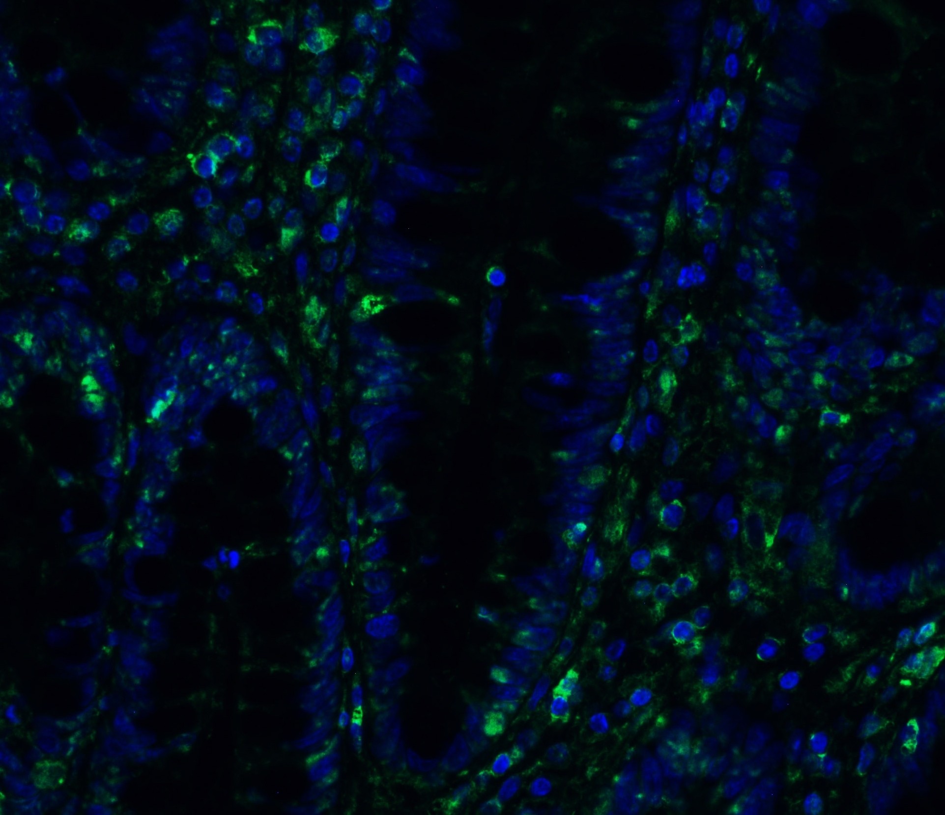 3 - TMEM41B (NT) Antibody ASC12205