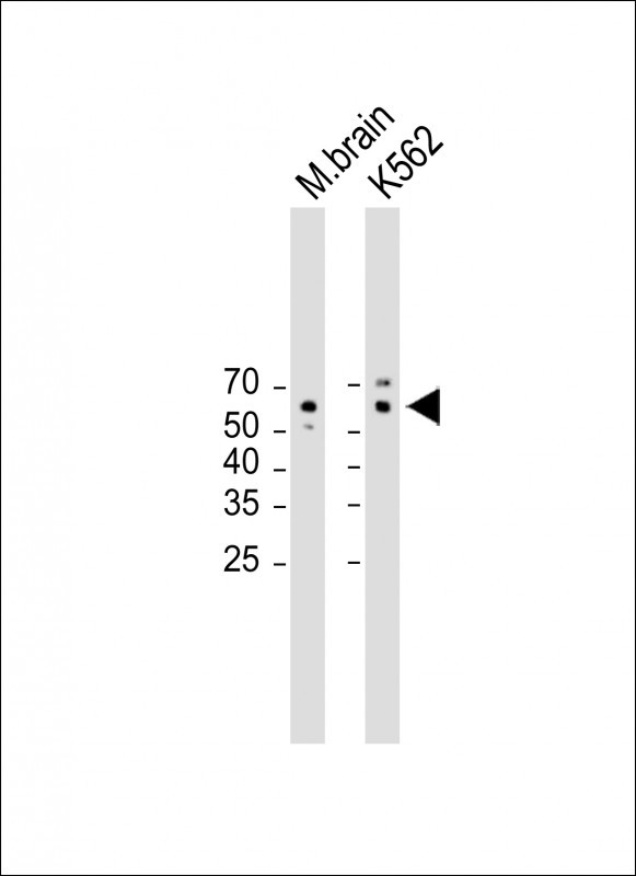 1 - Mouse Camkk1 Antibody (C-term) AP16901b