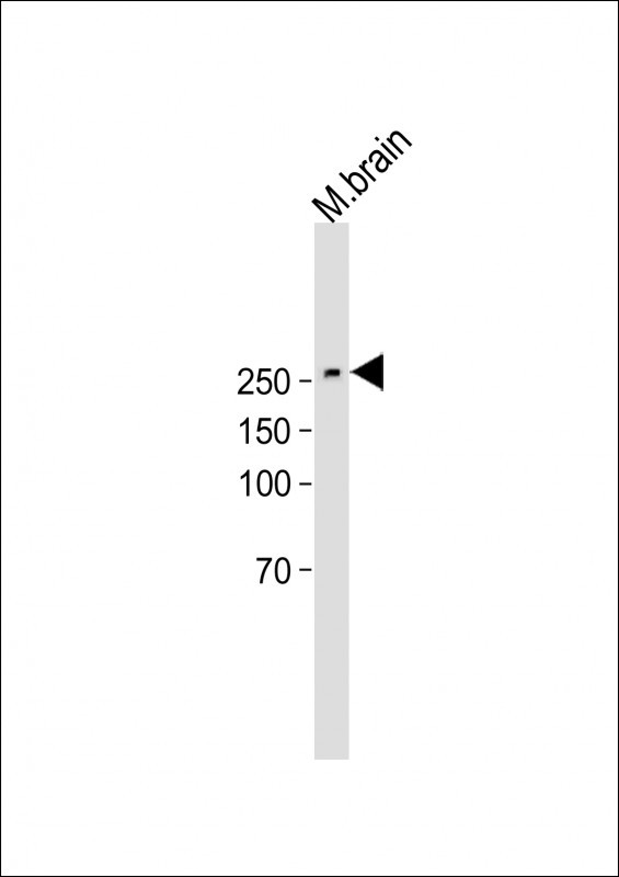 1 - SPTBN1 Antibody (C-Term) AP21995b