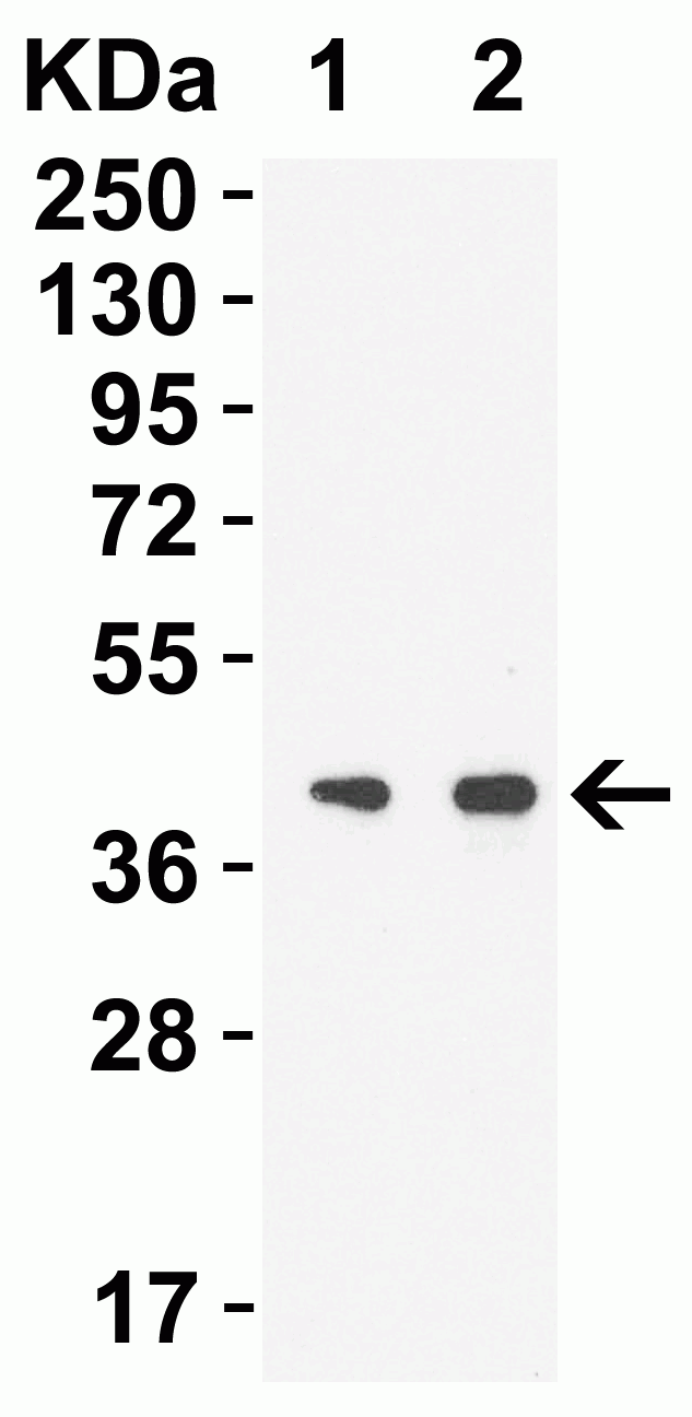 1 - SARS-CoV-2 (COVID-19) NSP15 Antibody ASC12215