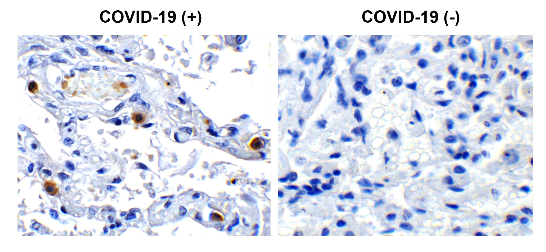 2 - SARS-CoV-2 (COVID-19) NSP16 Antibody ASC12216