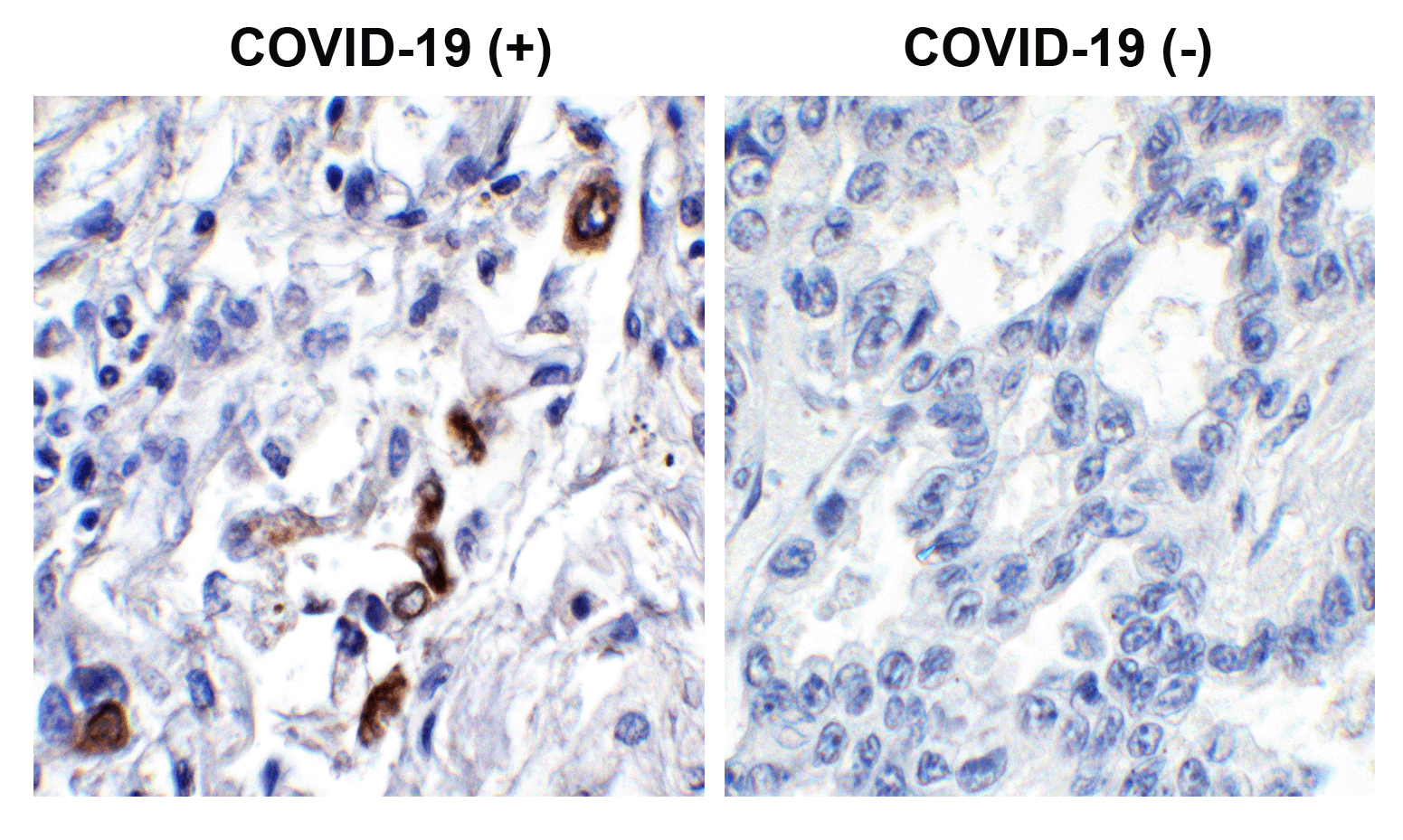 2 - SARS-CoV-2 (COVID-19) ORF3a Antibody ASC12217