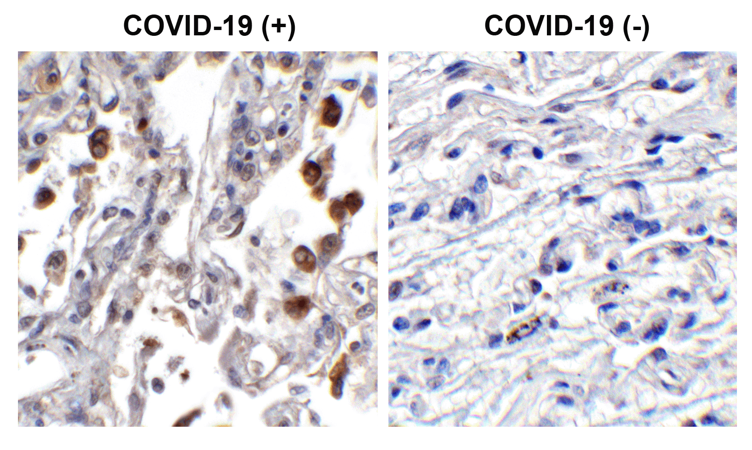 2 - SARS-CoV-2 (COVID-19) ORF3b Antibody ASC12219