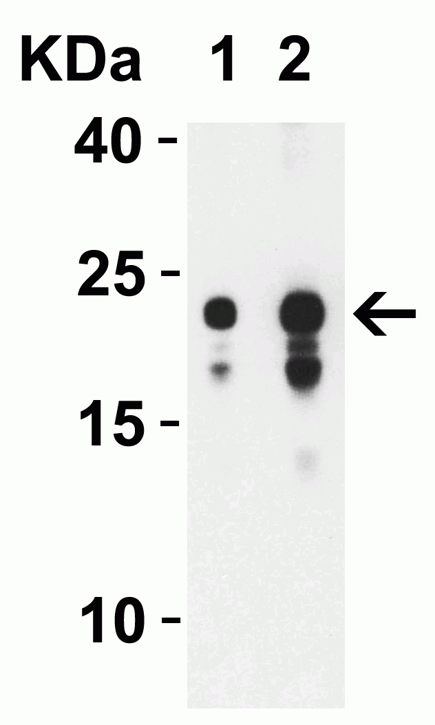 1 - SARS-CoV-2 (COVID-19) ORF3b Antibody ASC12218