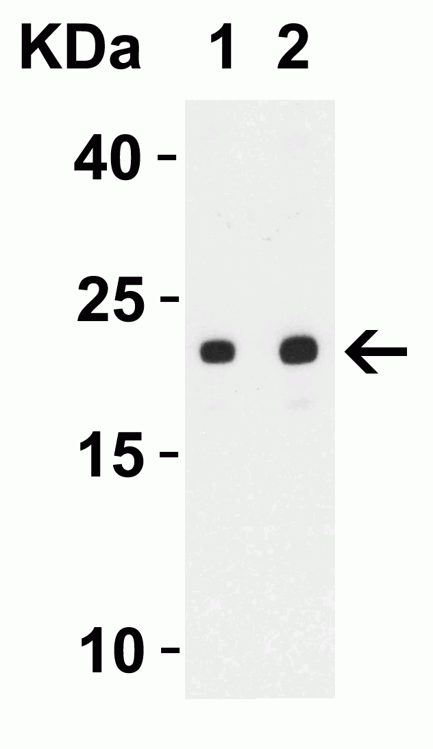 1 - SARS-CoV-2 (COVID-19) ORF3b Antibody ASC12219