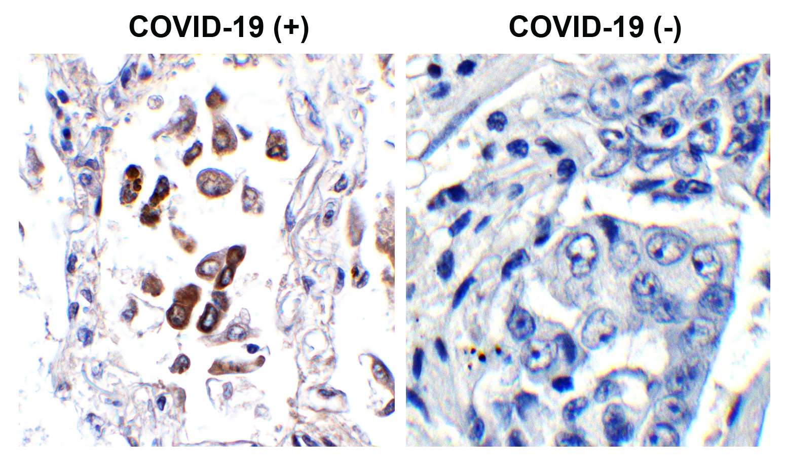 2 - SARS-CoV-2 (COVID-19) ORF8 Antibody ASC12223