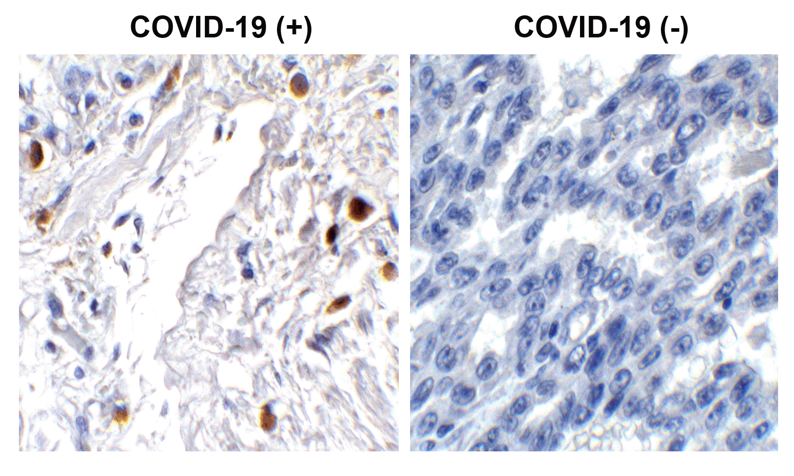 2 - SARS-CoV-2 (COVID-19) ORF7a Antibody ASC12222