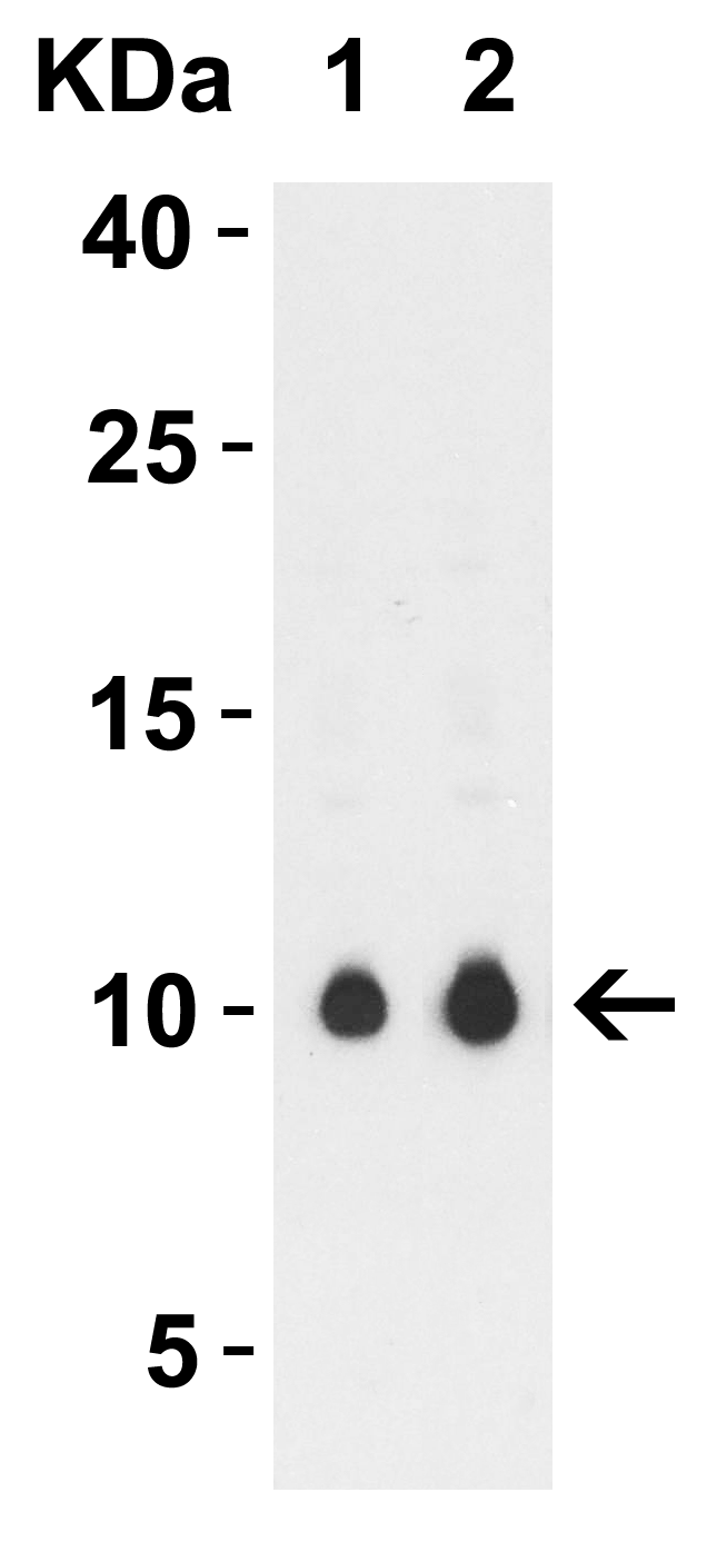 1 - SARS-CoV-2 (COVID-19) ORF9c Antibody ASC12225