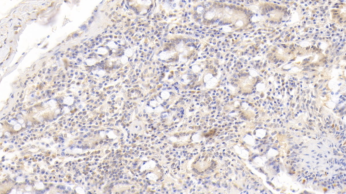 2 - Monoclonal Antibody to Interleukin 17 (IL17) AP74797