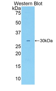 1 - Polyclonal Antibody to Activated Leukocyte Cell Adhesion Molecule (ALCAM) AP74511