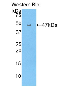 1 - Polyclonal Antibody to Angiotensin I Converting Enzyme (ACE) AP74512