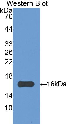1 - Polyclonal Antibody to Angiogenin (ANG) AP74515