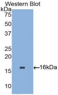 1 - Polyclonal Antibody to Angiopoietin 2 (ANGPT2) AP74712