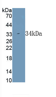 1 - Polyclonal Antibody to Connective Tissue Growth Factor (CTGF) AP74517