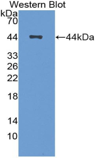 1 - Polyclonal Antibody to Brain Derived Neurotrophic Factor (BDNF) AP74521