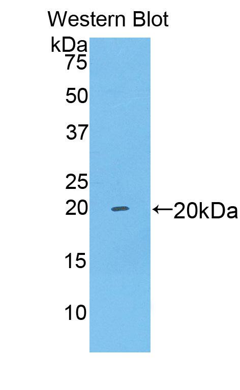 1 - Polyclonal Antibody to Brain Derived Neurotrophic Factor (BDNF) AP74654