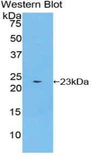 1 - Polyclonal Antibody to Bone Morphogenetic Protein 4 (BMP4) AP74522