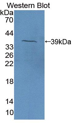 1 - Polyclonal Antibody to Eosinophil Chemotactic Factor (ECF) AP74526