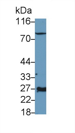 1 - Polyclonal Antibody to Erythropoietin (EPO) AP74495