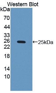 1 - Polyclonal Antibody to Colony Stimulating Factor 3, Granulocyte (GCSF) AP74733