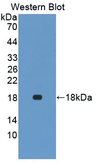 1 - Polyclonal Antibody to Interferon Gamma (IFNg) AP74499