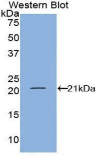 1 - Polyclonal Antibody to Interferon Gamma (IFNg) AP74693