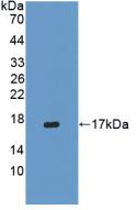 1 - Polyclonal Antibody to Interferon Gamma (IFNg) AP74498