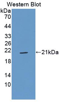 1 - Polyclonal Antibody to Insulin Like Growth Factor 2 (IGF2) AP74533