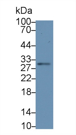 1 - Polyclonal Antibody to Interleukin 12A (IL12A) AP74537
