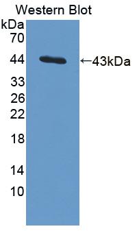 1 - Polyclonal Antibody to Interleukin 13 (IL13) AP74538