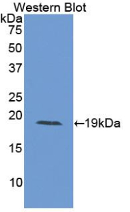 1 - Polyclonal Antibody to Interleukin 15 (IL15) AP74541