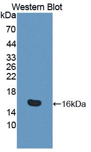 1 - Polyclonal Antibody to Interleukin 16 (IL16) AP74542