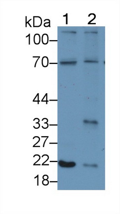 1 - Polyclonal Antibody to Interleukin 18 (IL18) AP74543