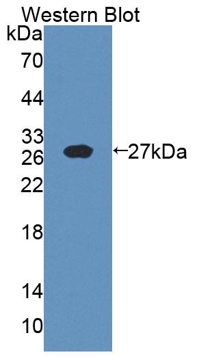 1 - Polyclonal Antibody to Interleukin 18 (IL18) AP74545